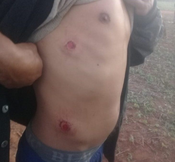 Denuncian violenta represión policial a comunidad indígena en Itakyry