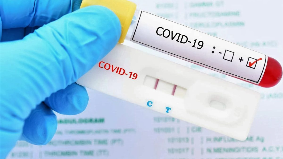 Se duplicaron casos confirmados de Coronavirus en Alto Paraná